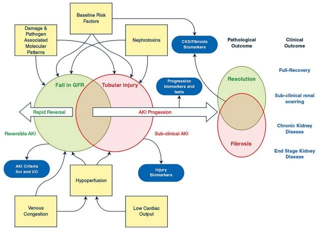 Simplifed overview of AKI pathophysiology illustrating the heterogeneity in etiology