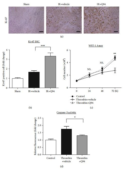 Figure 4: PAR-1 inhibition on the proliferation of tubular cells. Figure 4: PAR-1 inhibition on the proliferation of tubular cells.