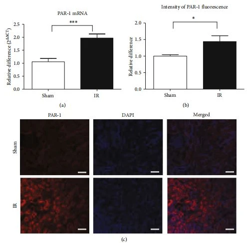 Figure 1: Expression of PAR-1 was upregulated in the kidney. The expression of PAR-1 mRNA was increased in the renal tissues after IR (a). Quantitative analysis of the intensity of anti-PAR-1 fluorescence in sham and IR kidneys (b) and corresponding representative images (c) (n = 7-8). Bars = 25 μm. ∗∗∗p < 0:001 vs. sham. ∗p < 0:05 vs. sham. Figure 1: Expression of PAR-1 was upregulated in the kidney. The expression of PAR-1 mRNA was increased in the renal tissues after IR (a). Quantitative analysis of the intensity of anti-PAR-1 fluorescence in sham and IR kidneys (b) and corresponding representative images (c) (n = 7-8). Bars = 25 μm. ∗∗∗p < 0:001 vs. sham. ∗p < 0:05 vs. sham.