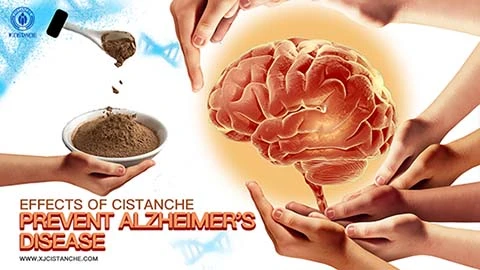 Anti Alzheimer's disease (2) Anti Alzheimer's disease (2)